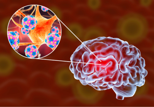 World Meningitis Day